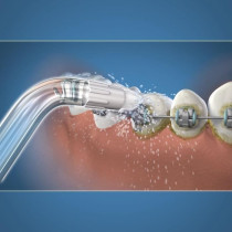 Embout Hydropulseur - WATERPIK - Orthodontique - Élimine la plaque -