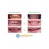 MACHOUYOU 1st Teething Device - Nipple Withdrawal
